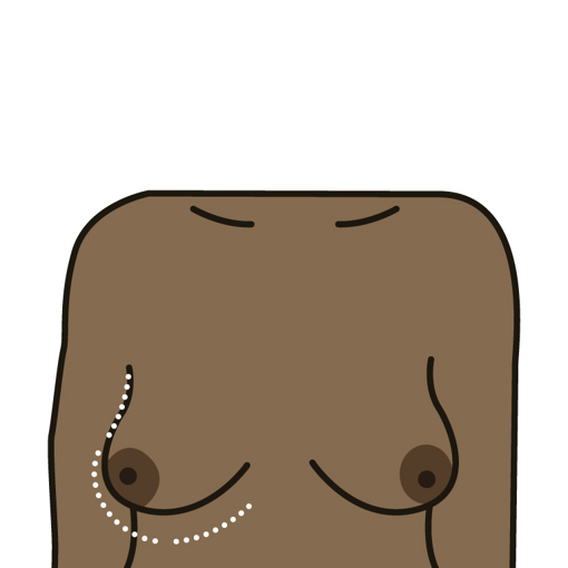 Changes in size or shape