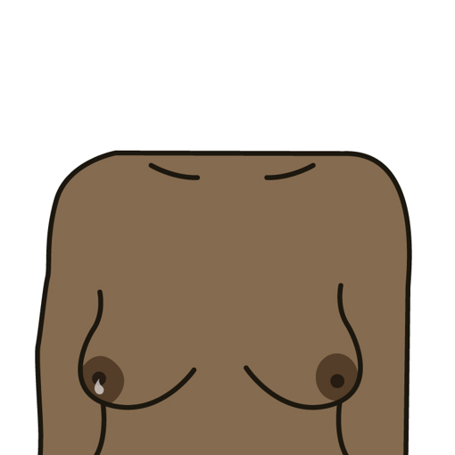 Unusual liquid (discharge) from either nipple